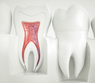 animated tooth before root canal