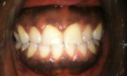 Smile before cosmetic dentistry