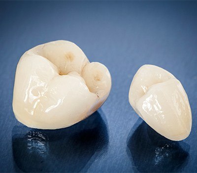 two types of dental crowns
