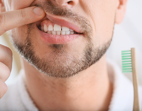 Close up of a man pointing to his gums