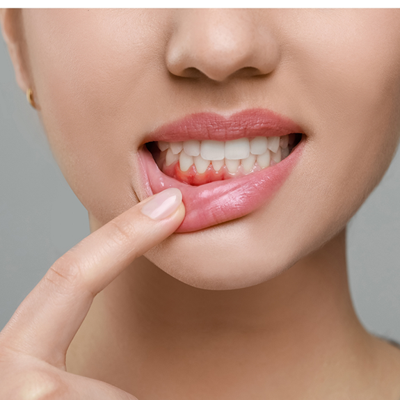 Woman pointing to a red spot in her gums