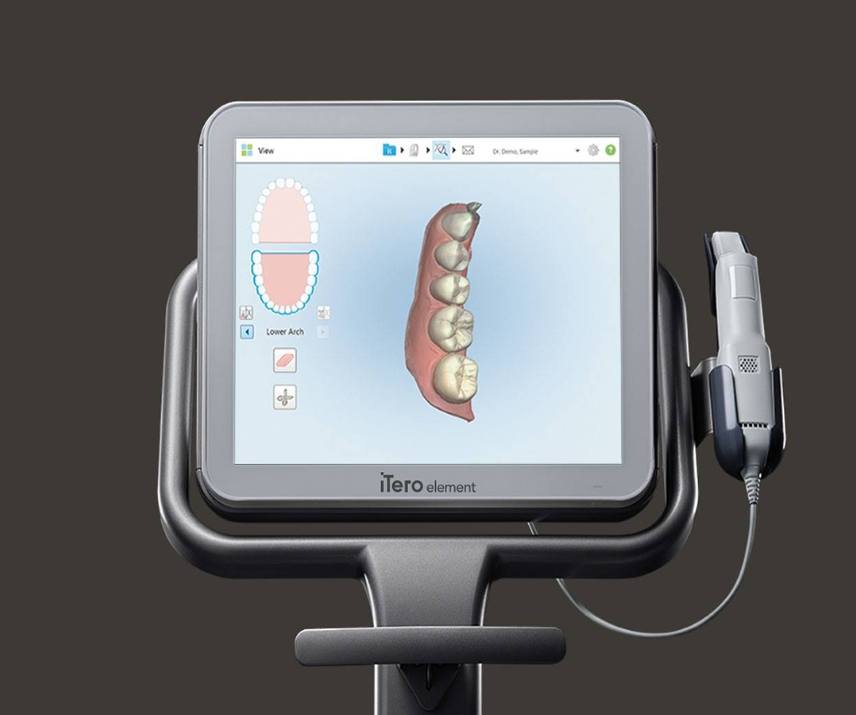 itero element dental impression machine