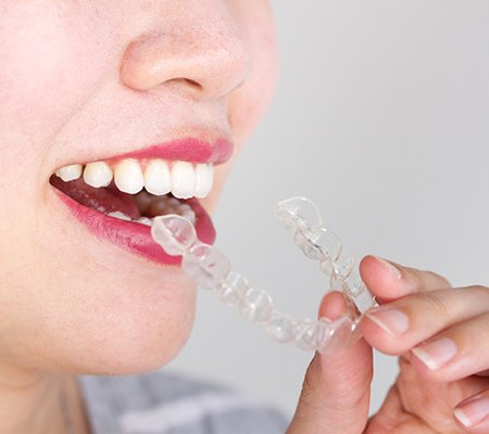 Woman removing Invisalign aligner from mouth 