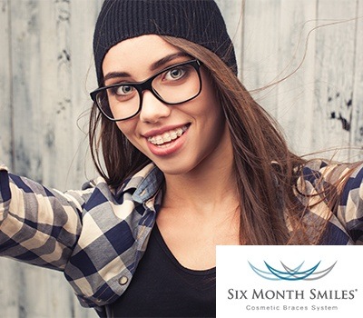 girl with six month smiles braces