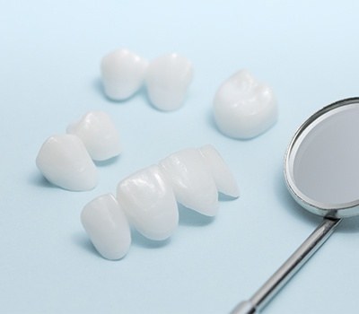 multiple examples of porcelain veneers