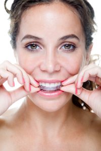 A complete guide to caring for your Bowie Invisalign braces.