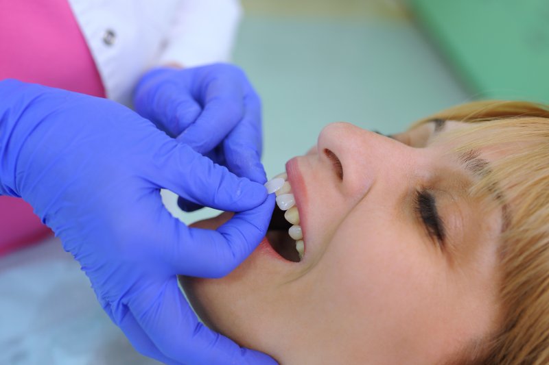 A woman receiving veneers